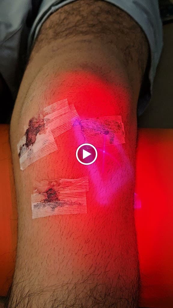 OrthoLazer Chelmsford photo 3