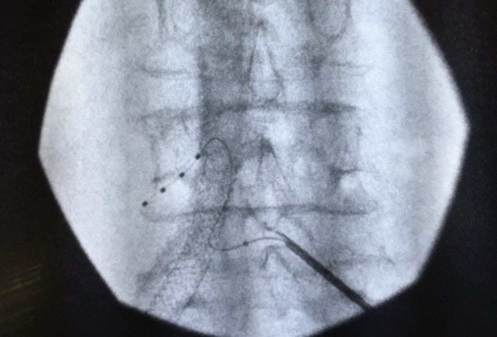 Stuart Hough, MD photo 2