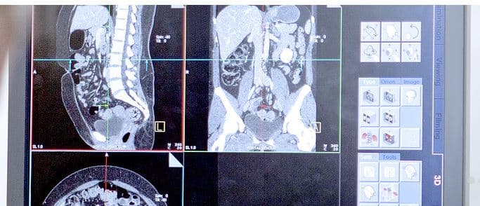 Narinder Grewal, MD photo 4