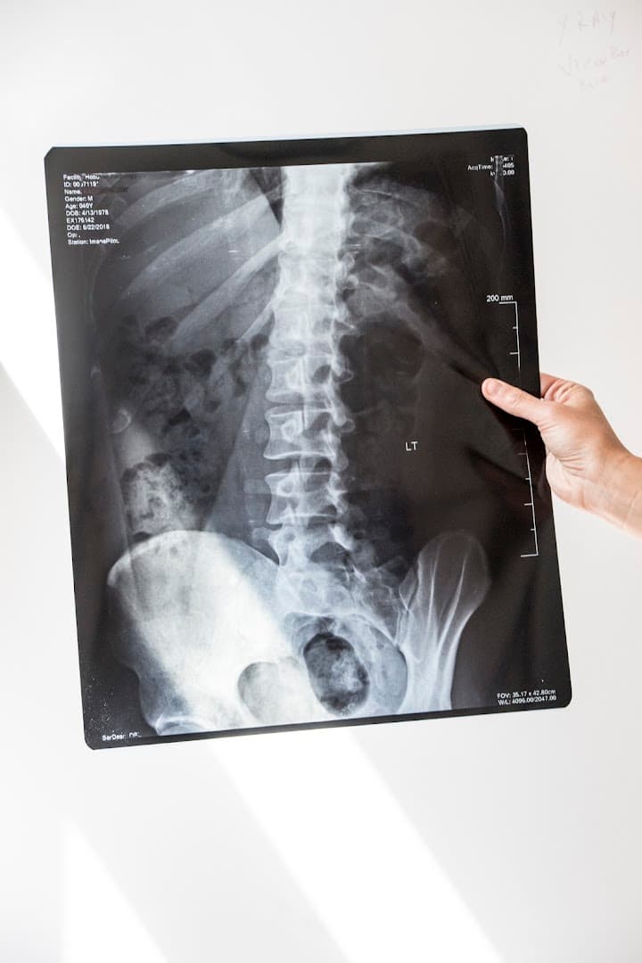 Visco Spine & Joint Center photo 4