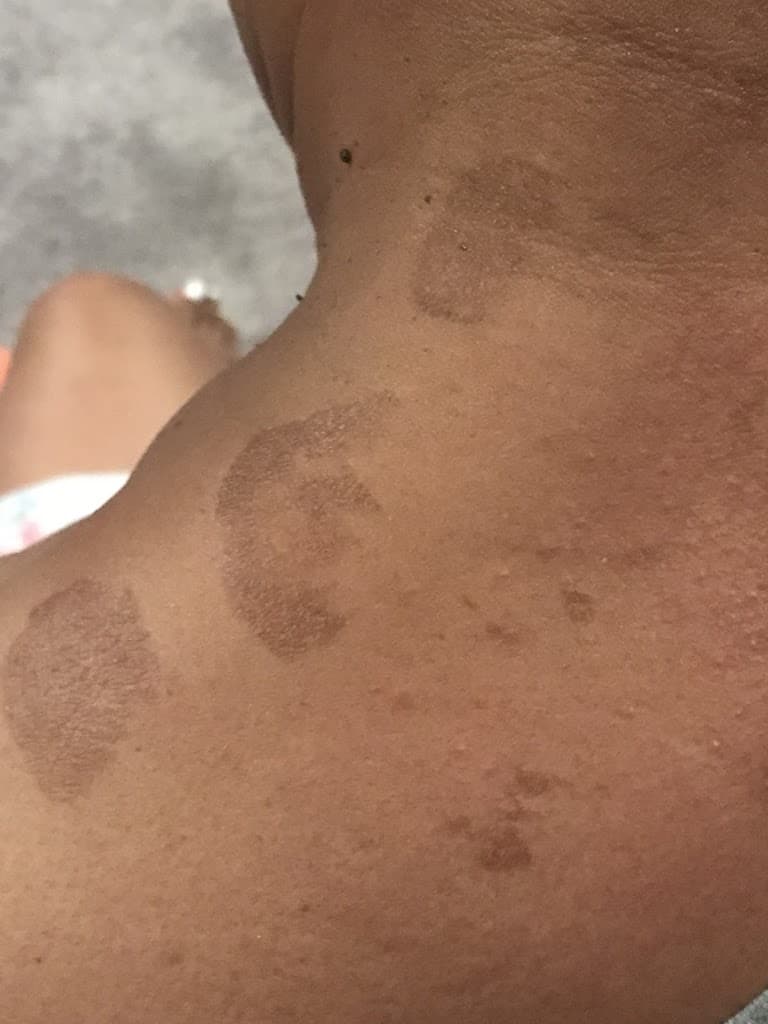 Metro Spine Pain Centers